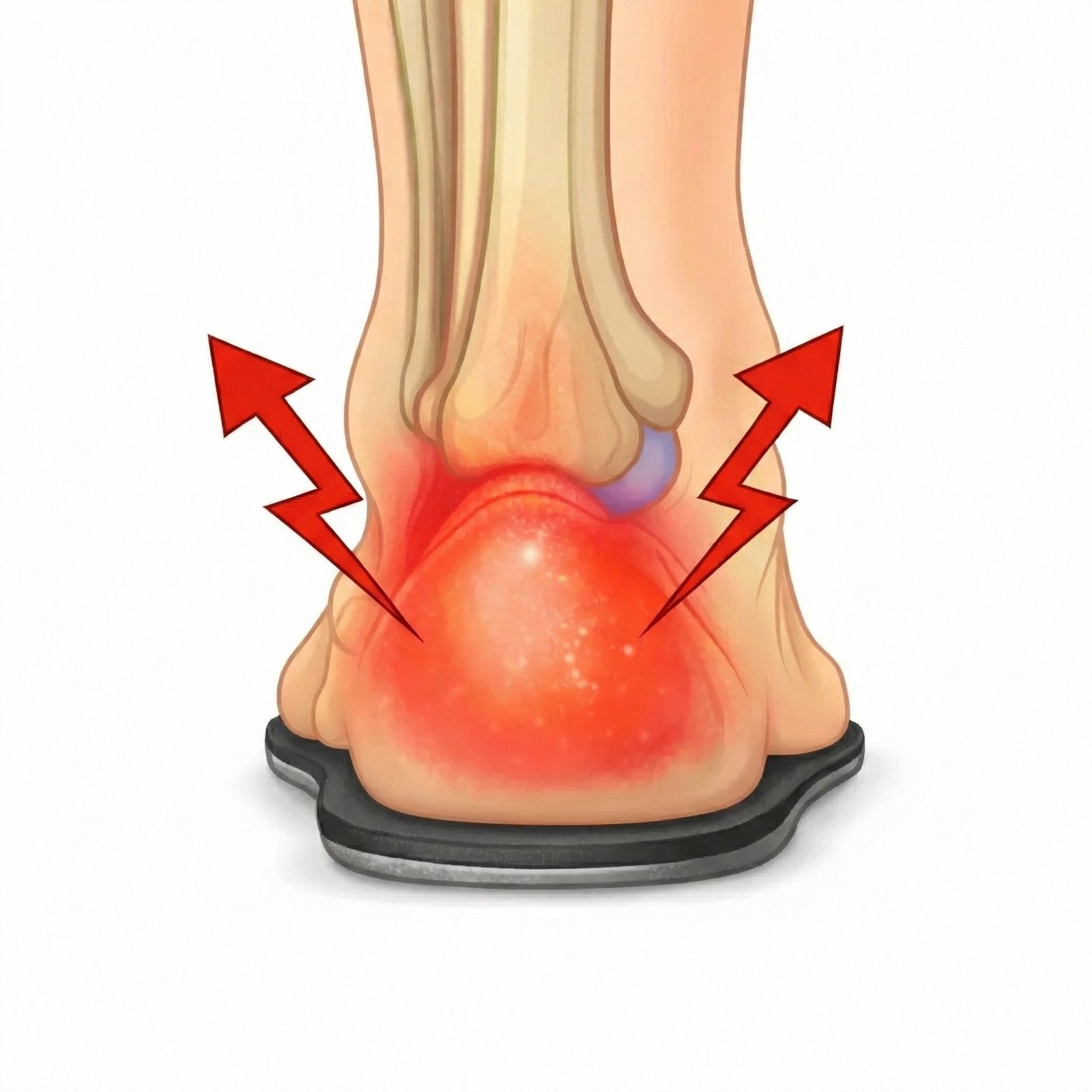 Poor insole quality illustration